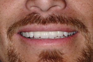 Patient 7: after