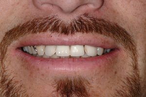 Patient 7: before