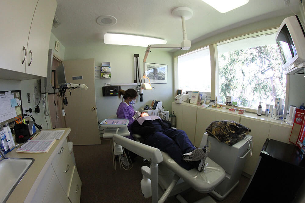 porcelain veneers and stone mockup