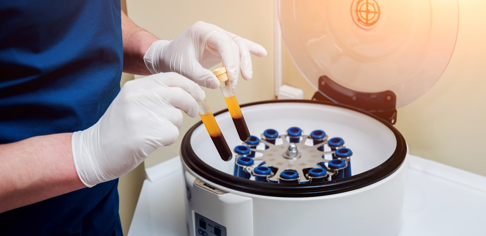 dentist preparing platelet rich plasma