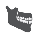weak jawbone