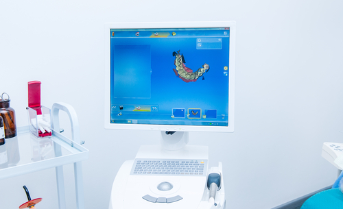 CAD/CAM system
